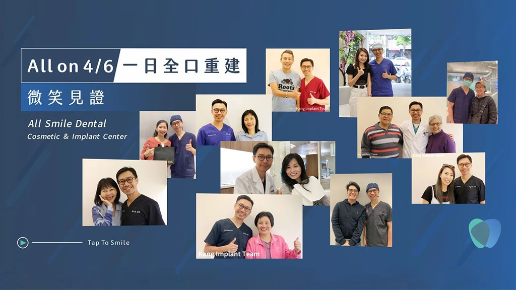 All-on-4一日全口重建 專業口碑