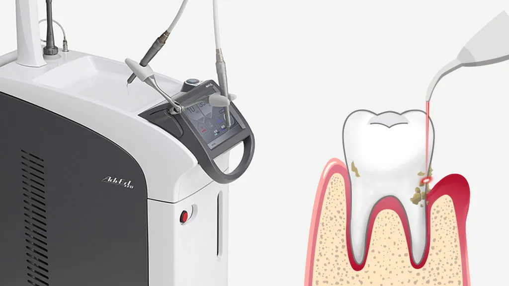 牙周權威|陳品熹院長