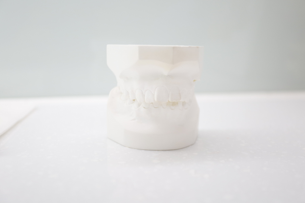大家對牙齒矯正可能會有的4種疑惑：症狀、拔牙、戴牙套、飲食
