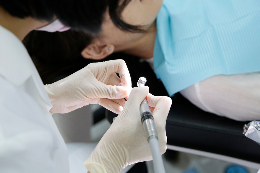 【補牙攻略】3D齒雕的治療推薦、過程介紹