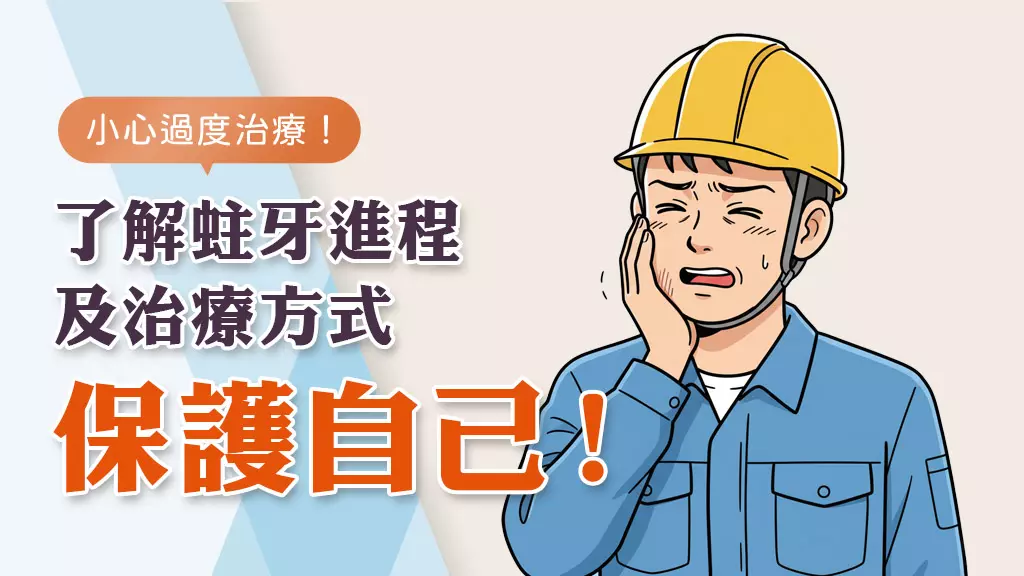 保住真牙！了解蛀牙進程及治療方式，避免被過度治療