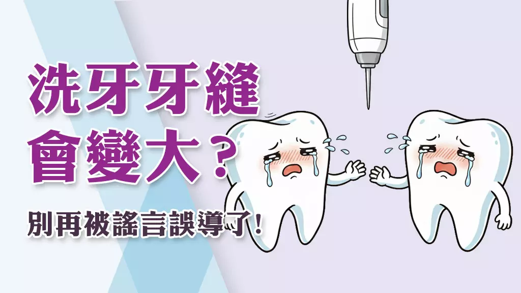 牙醫師解析：洗牙、植牙與矯正的常見誤解與迷思