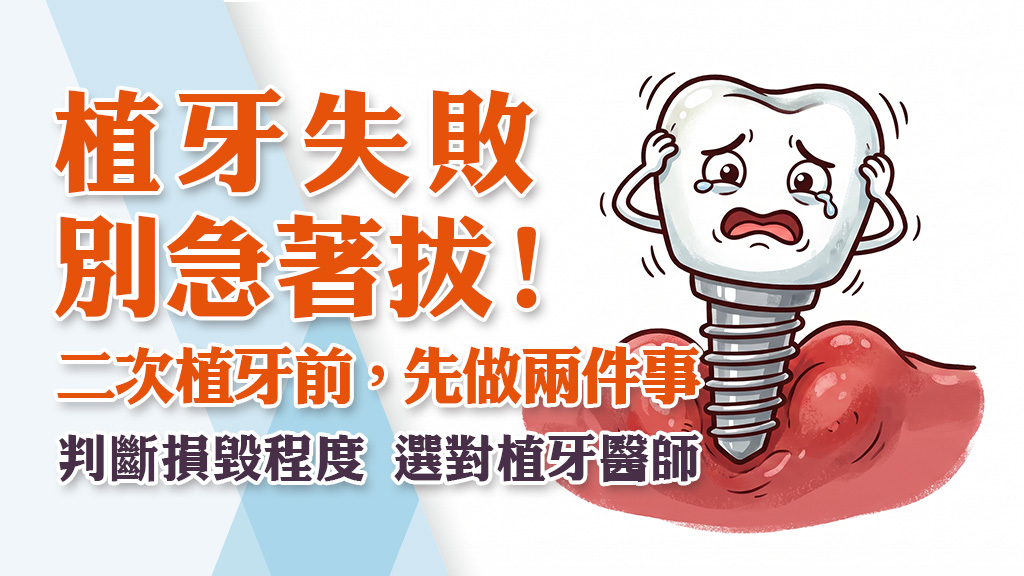 植牙失敗別急著拔！二次植牙前，你該先做的兩件事：判斷植牙損毀程度與選對植牙醫師