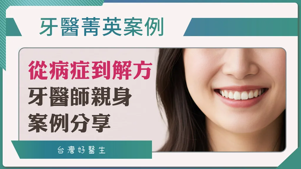 口腔狀況複雜怎麼辦？欣美牙醫鄭胤捷院長全口重建案例：一次解決植牙、牙齒矯正等困擾